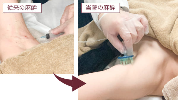 森の中で両腕をあげている健康的な女性