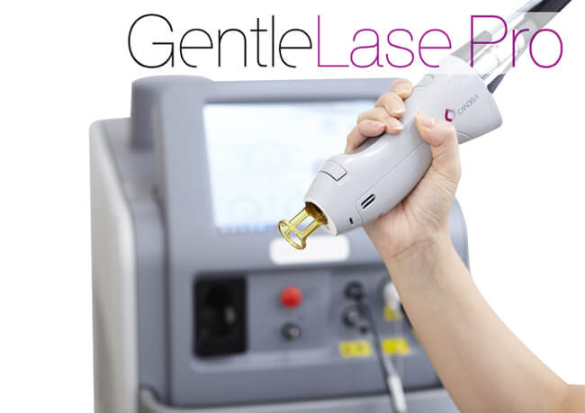 すずき内科で使用する光治療機器「gentlelasepro(ジェントルレーズプロ)」